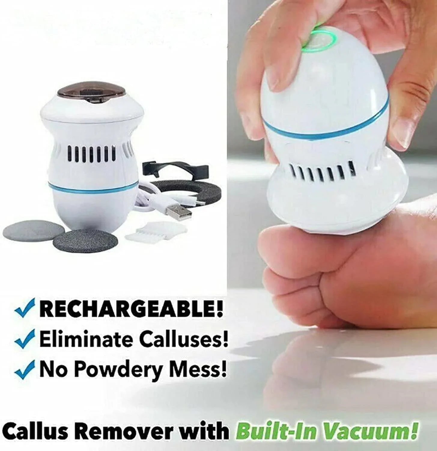 Electric Callus Remover